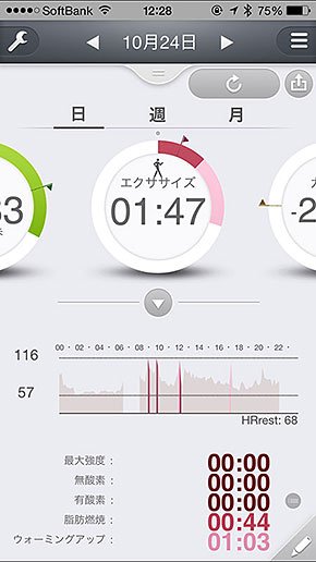 PULSENSE View