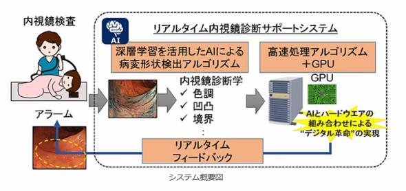 人工知能を用いた「大腸がん」発見システム