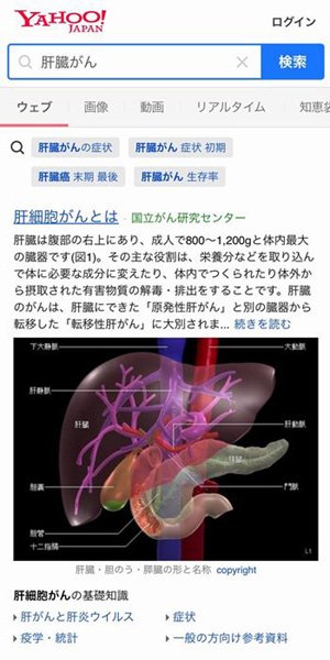 がん