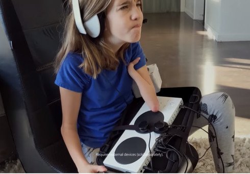  xbox 1