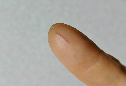  finger 1