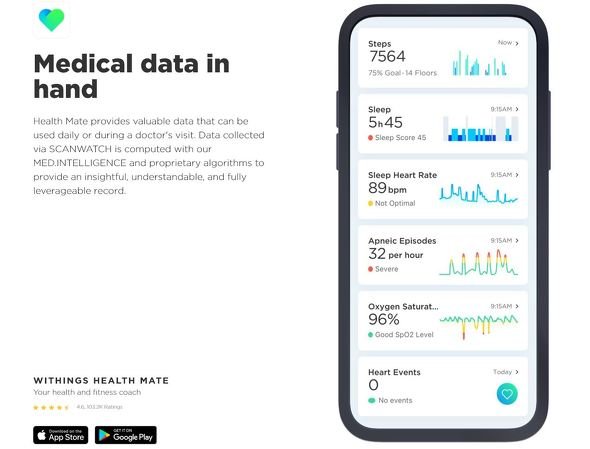 scanwatch 2