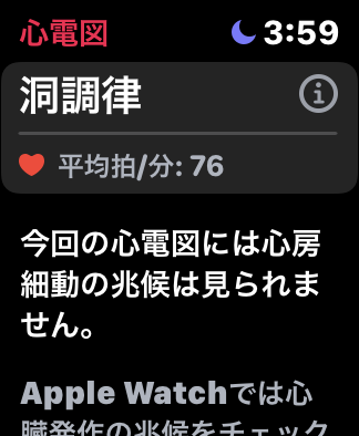 Apple Watchの心電図計測後