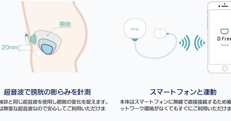 もらしそう」心配な人に……排尿予測センサー「DFree Personal」一般発売